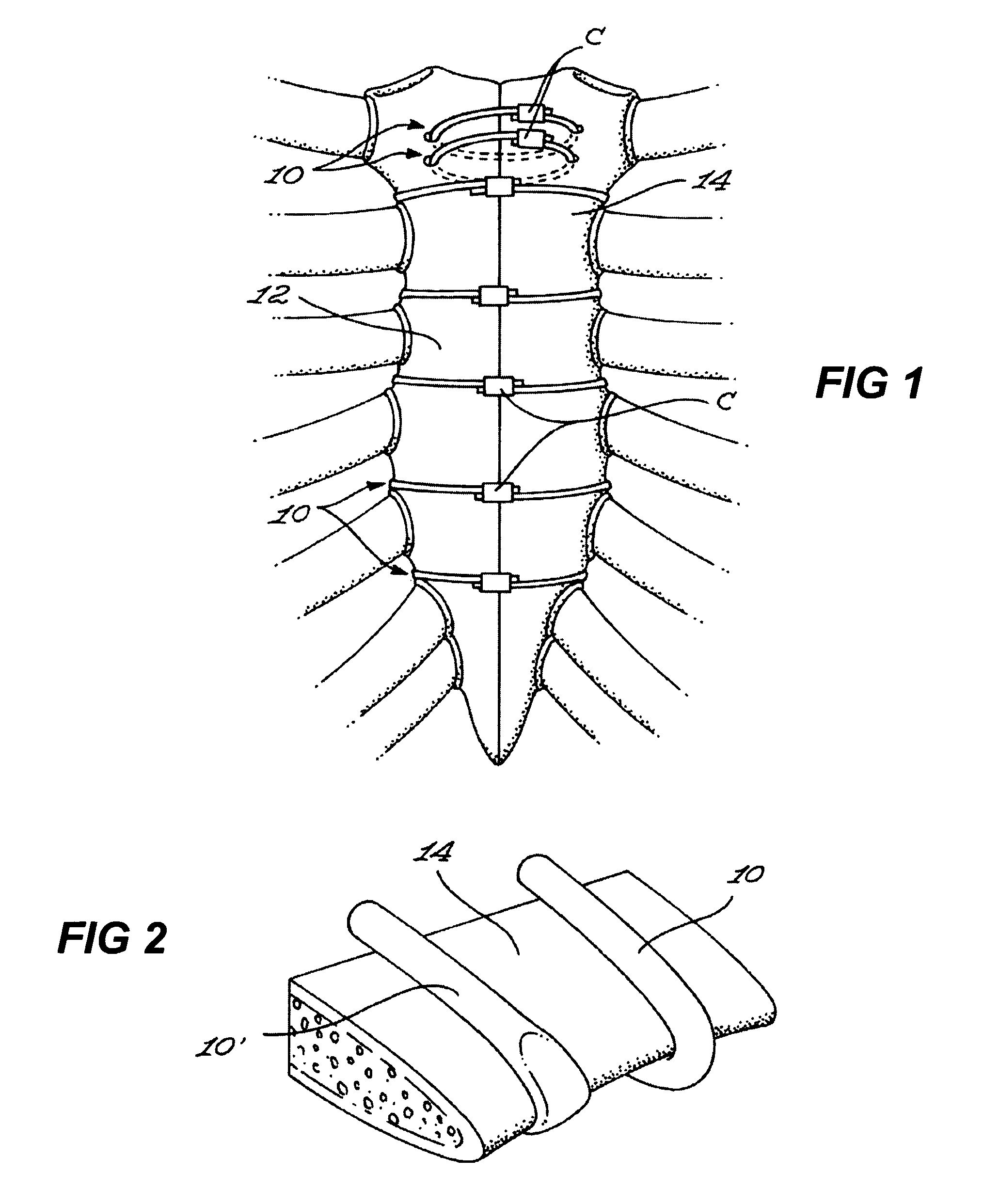 Binding component