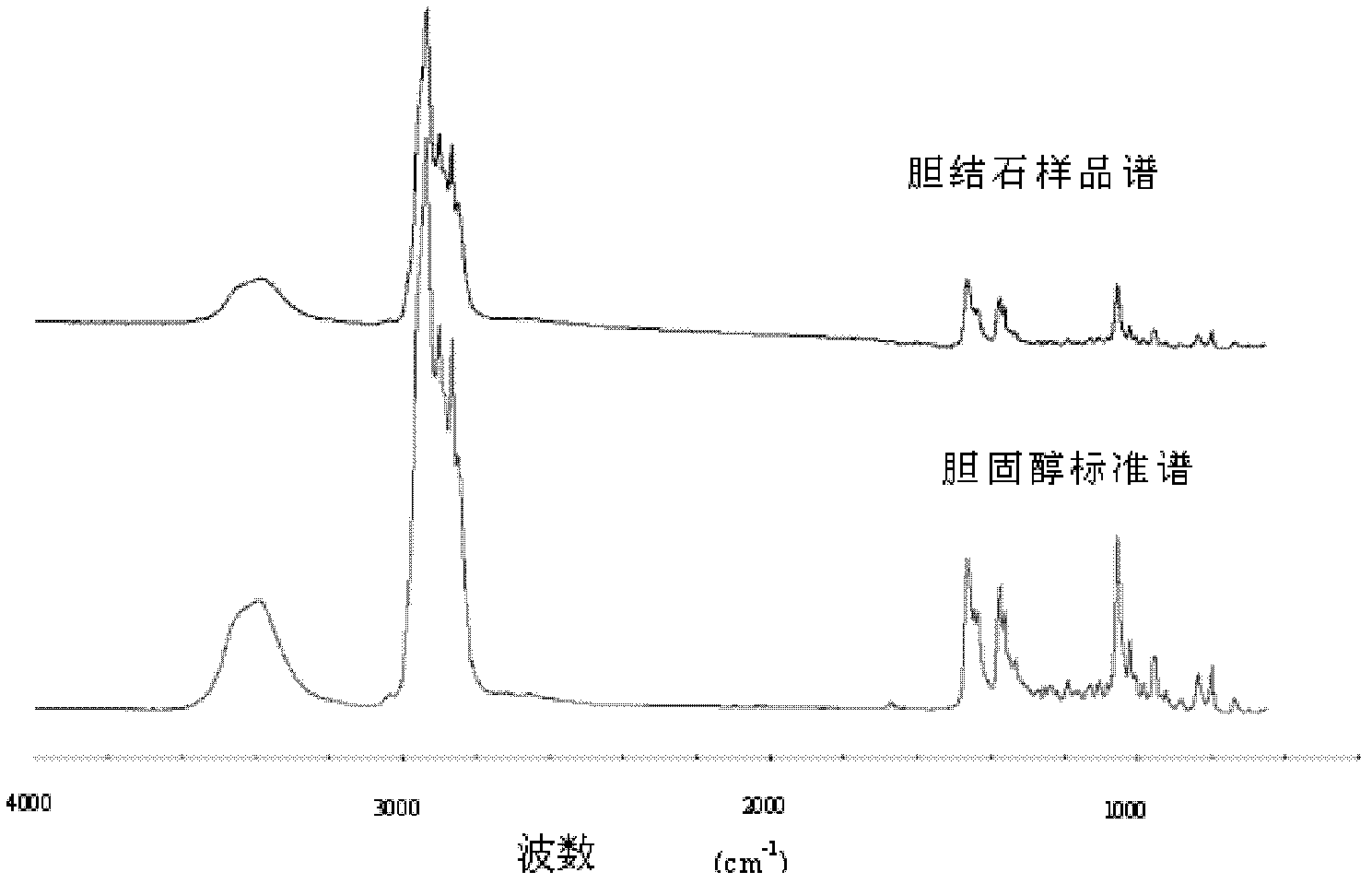 Monolauryl phosphate-containing lithontriptic for litholysis of cholesterol gallstone