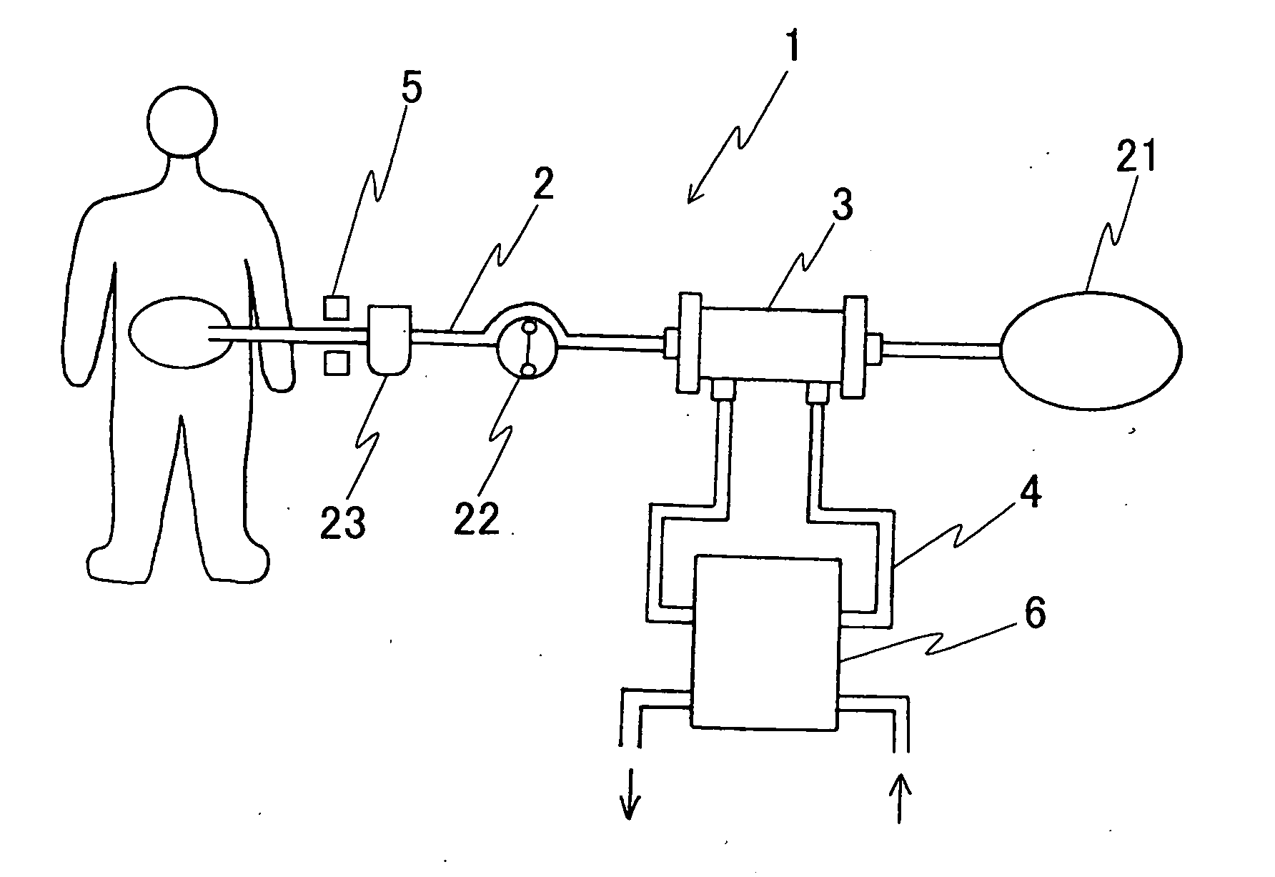 Peritoneal dialyzer and method of peritoneal dialysis