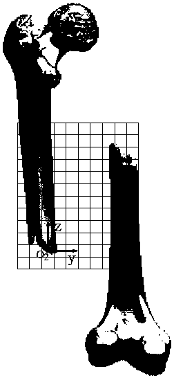 Route planning method for robot assisted fracture reduction