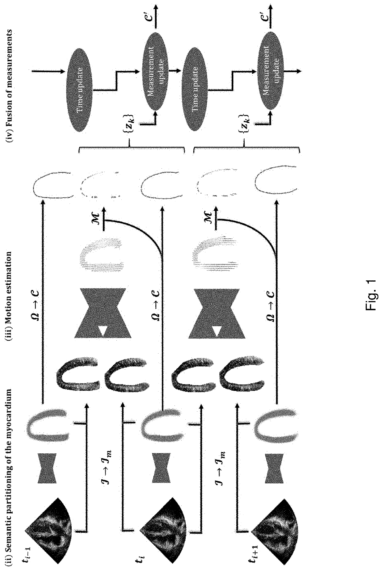 Functional measurements in echocardiography