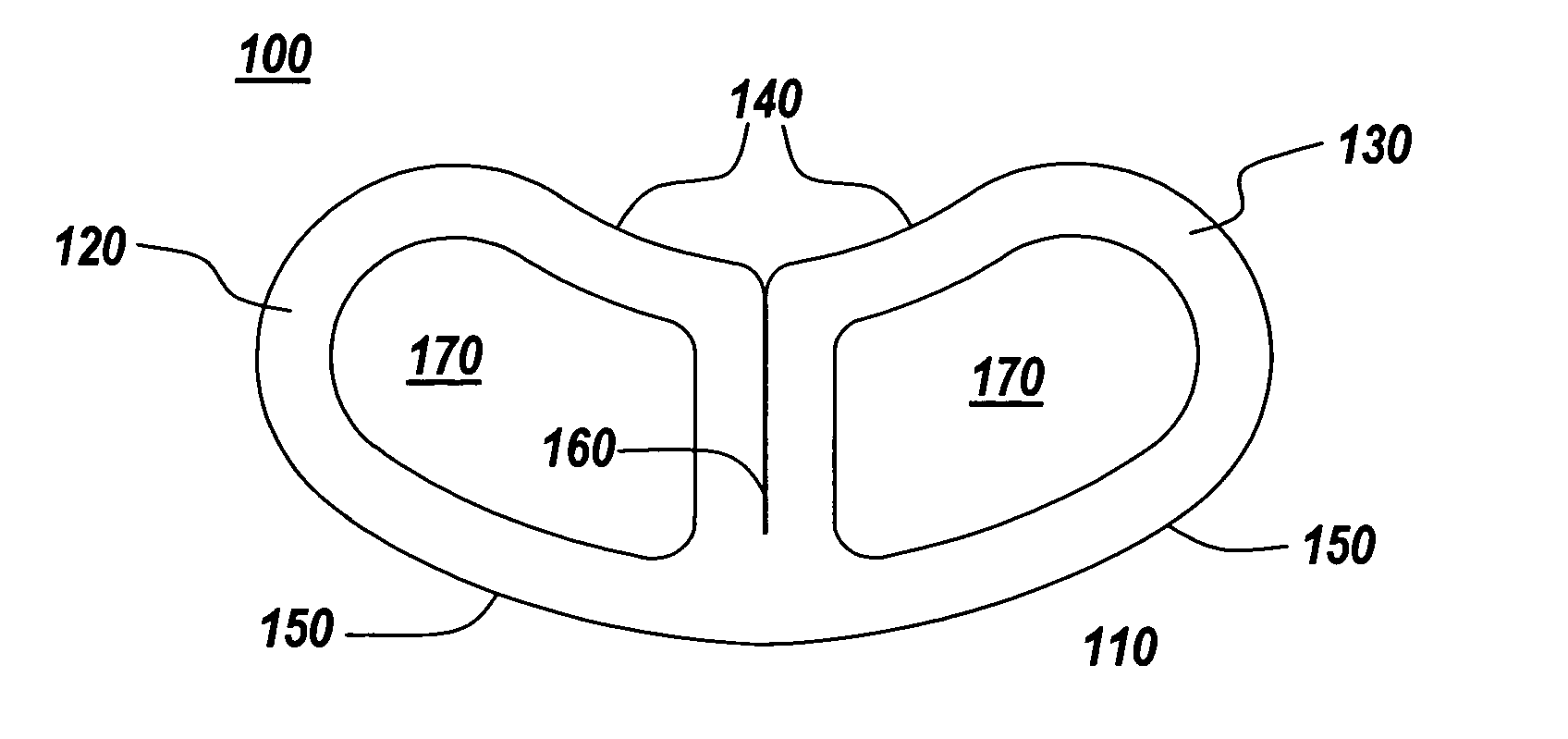 Spinal fusion implant