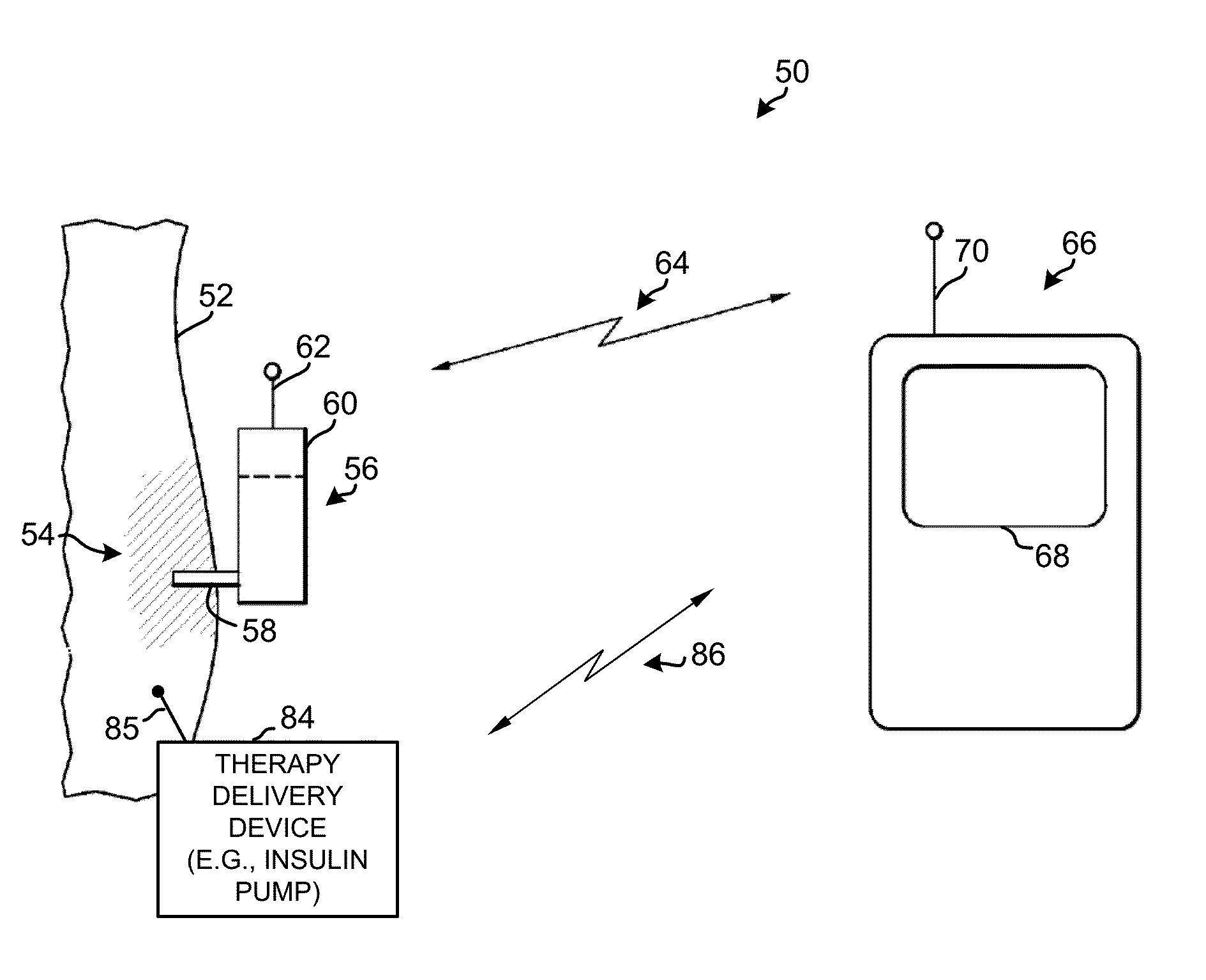 System and method for adjusting therapy based on risk associated with a glucose state