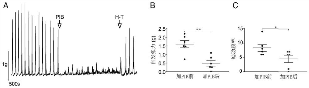 Constipation pathogenic bacteria and application thereof