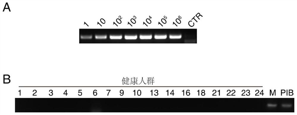 Constipation pathogenic bacteria and application thereof