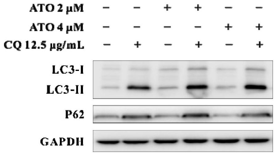 A nanomaterial-based autophagy blocking system and its preparation method, and its application in the treatment of solid tumors with arsenic drugs