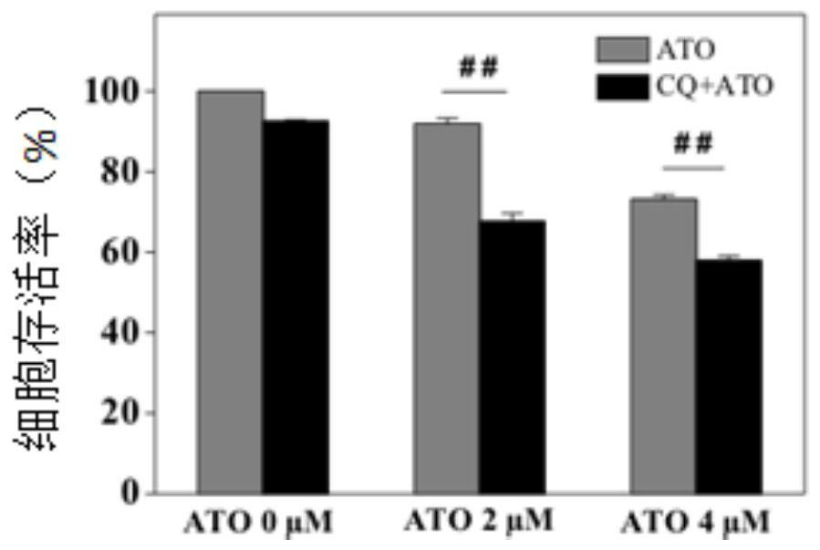 A nanomaterial-based autophagy blocking system and its preparation method, and its application in the treatment of solid tumors with arsenic drugs