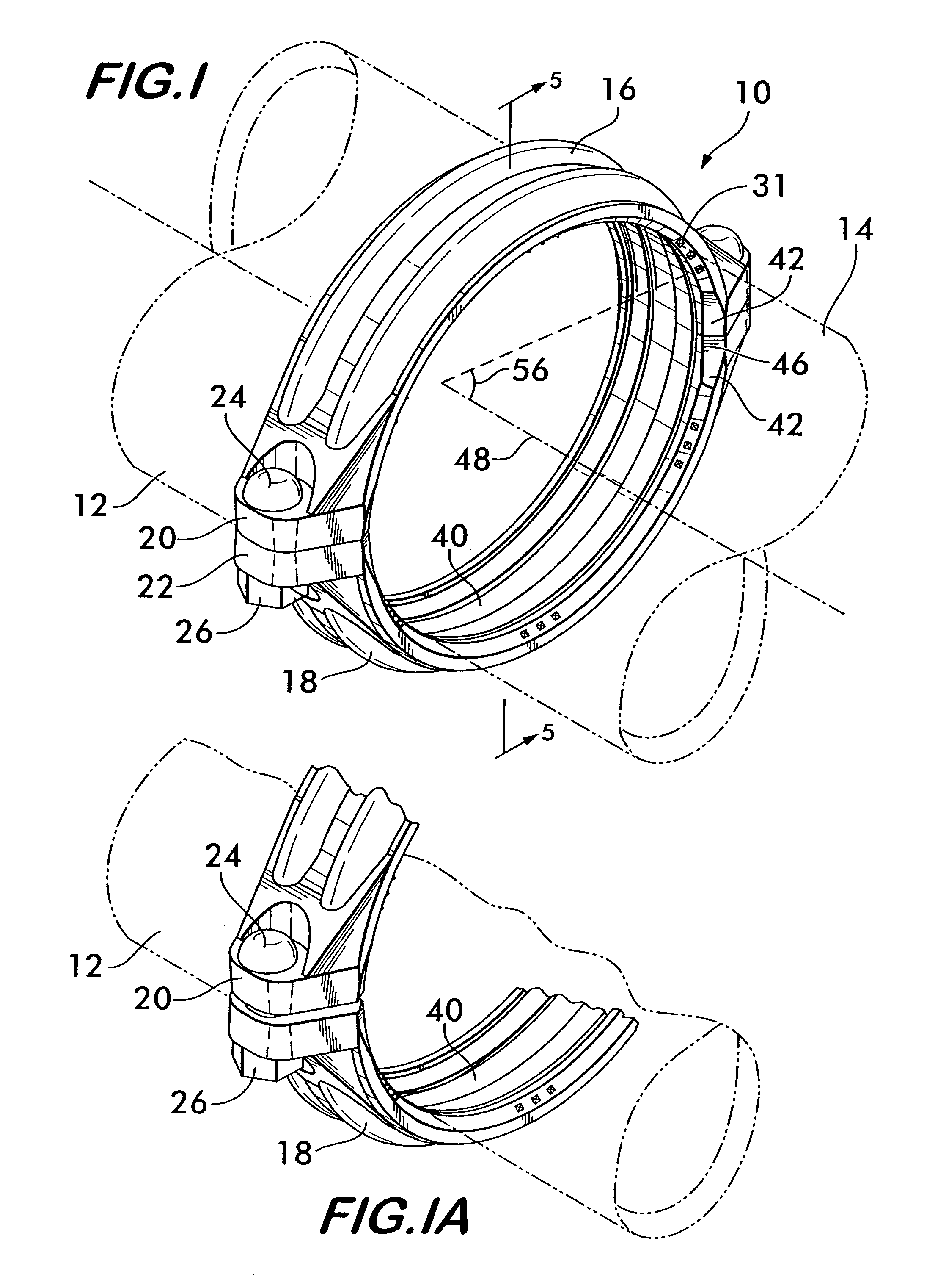 Pipe coupling having wedge shaped keys