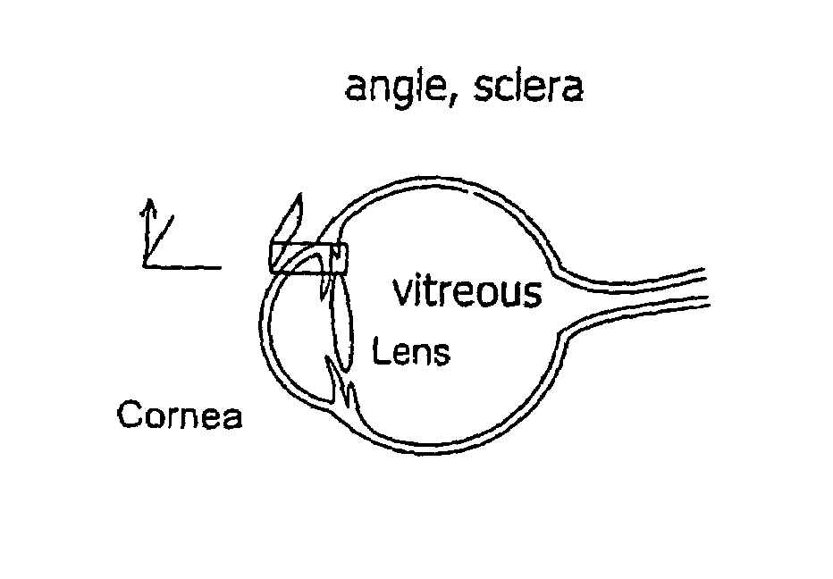 Surgical tool and method for extracting tissue from wall of an organ