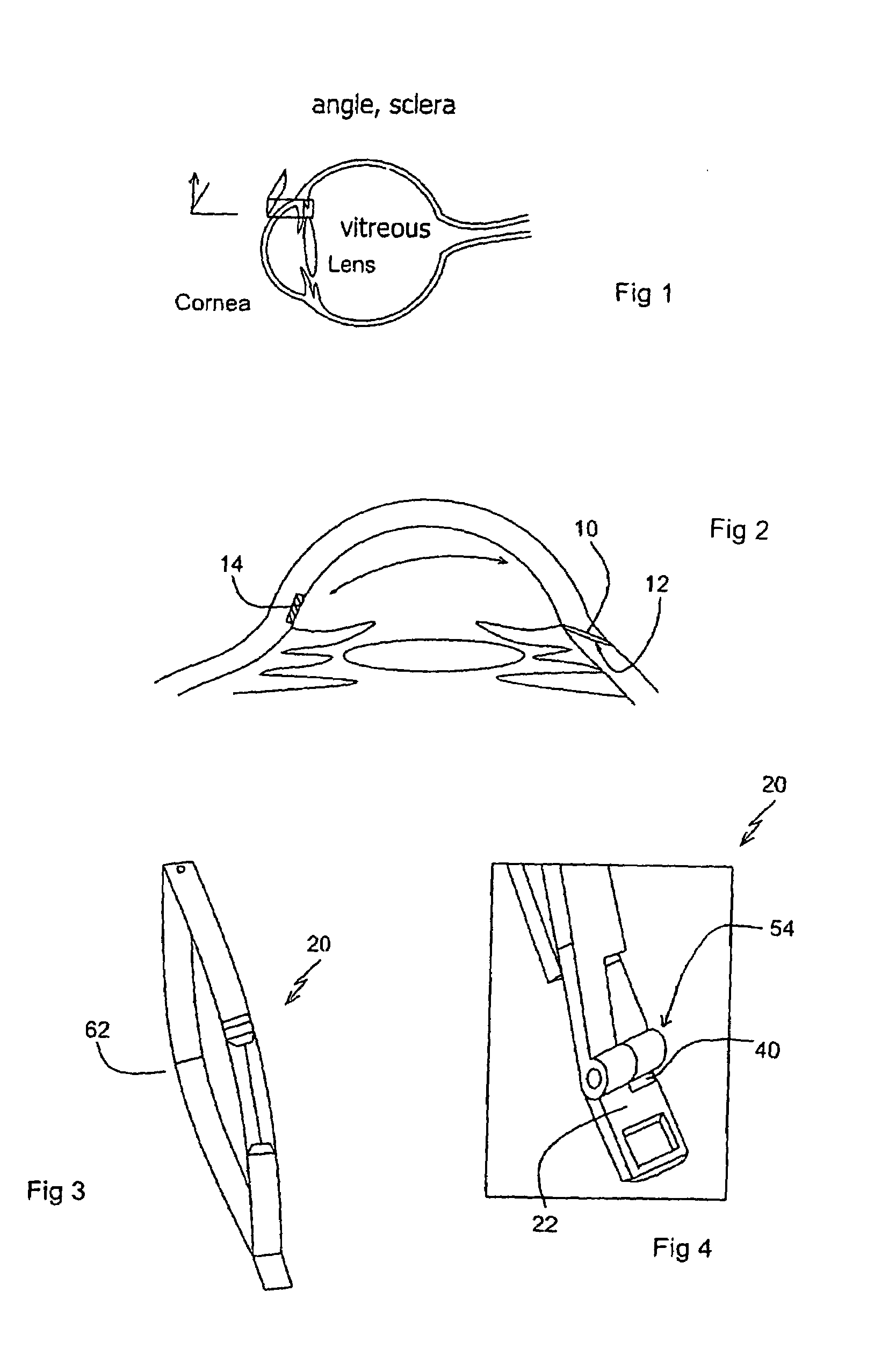 Surgical tool and method for extracting tissue from wall of an organ