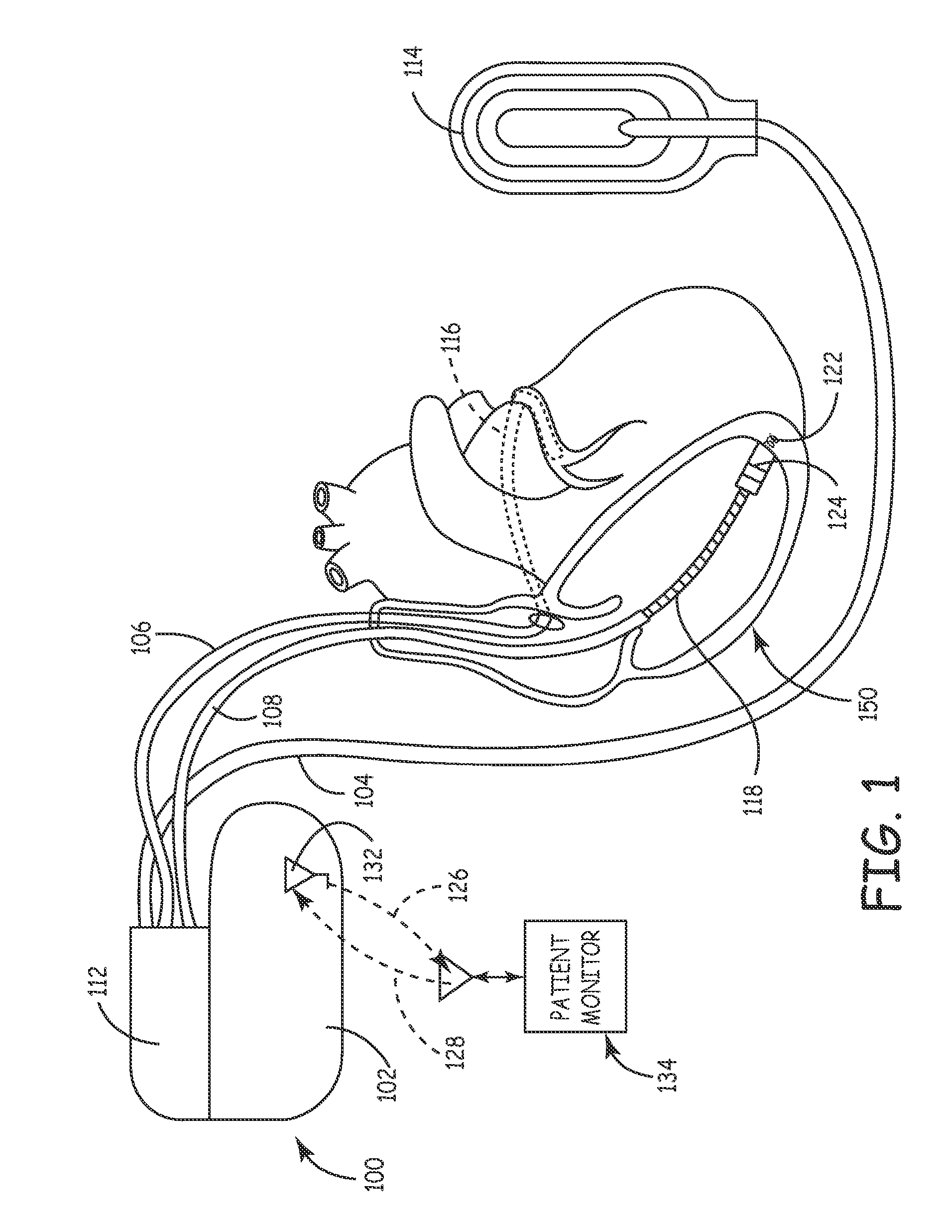 System and Method for Real-Time Remote Monitoring of Implantable Medical Devices