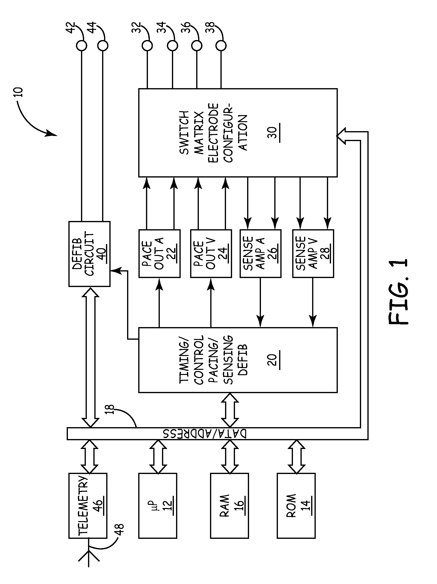 Implantable medical device with real time T-wave oversensing detection