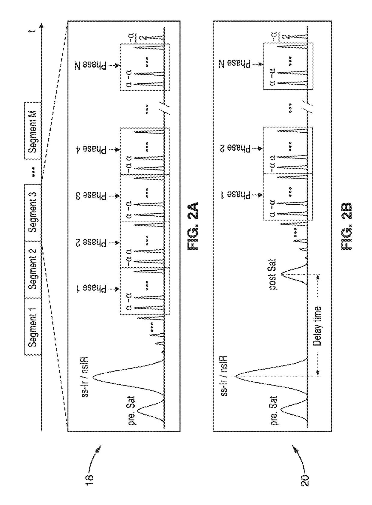 Noninvasive 4-D time-resolved dynamic magnetic resonance angiography