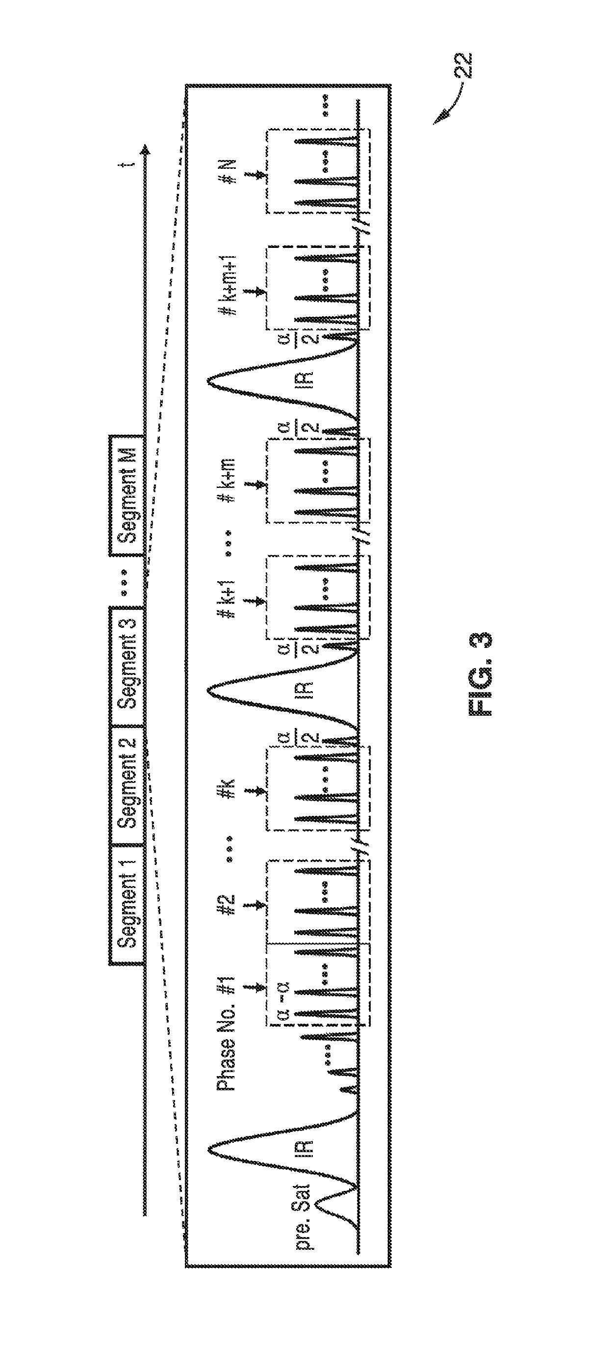 Noninvasive 4-D time-resolved dynamic magnetic resonance angiography