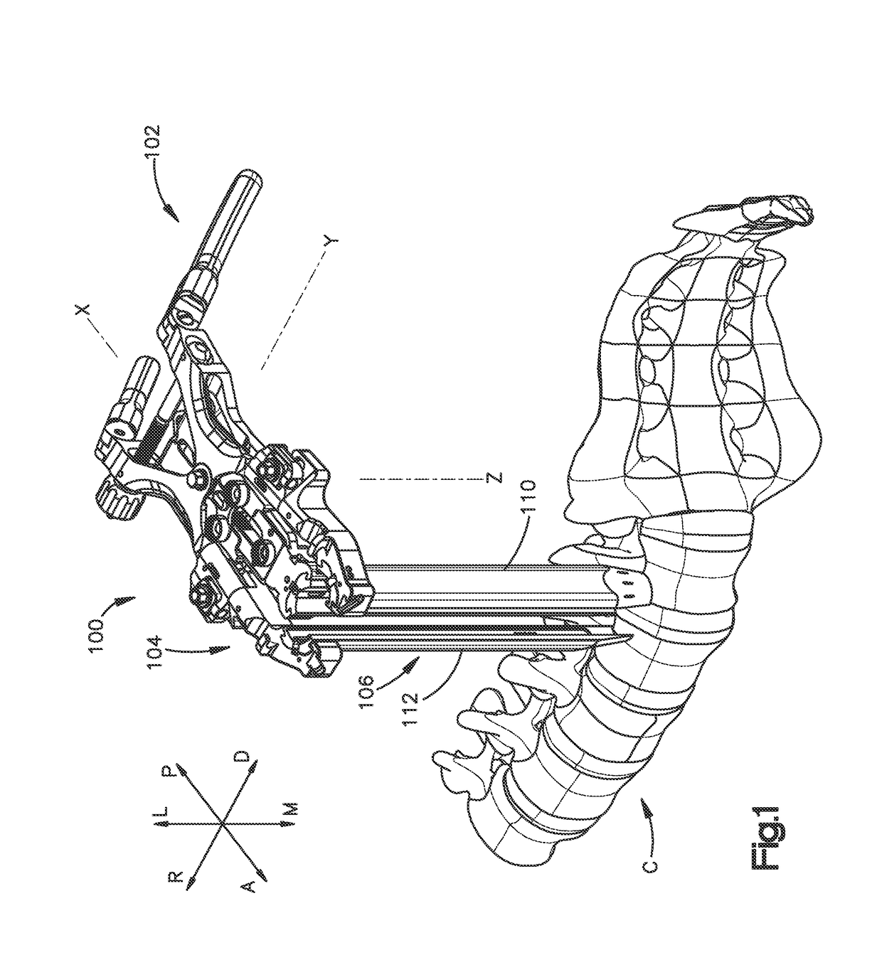 Spinal access retractor