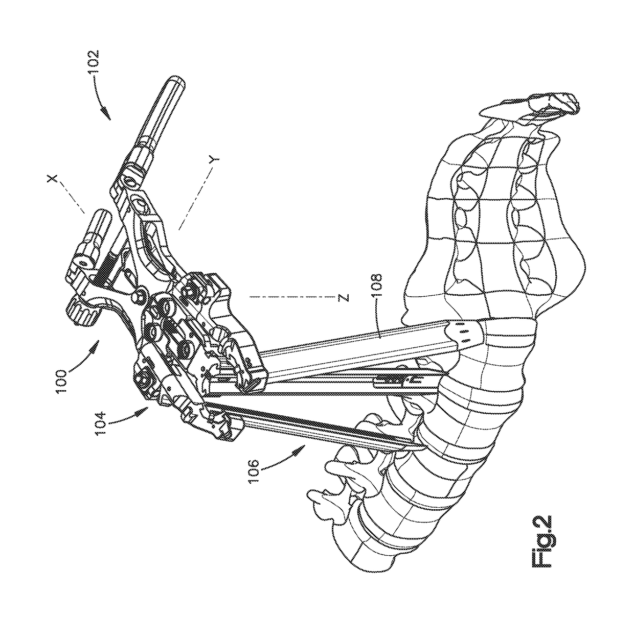 Spinal access retractor