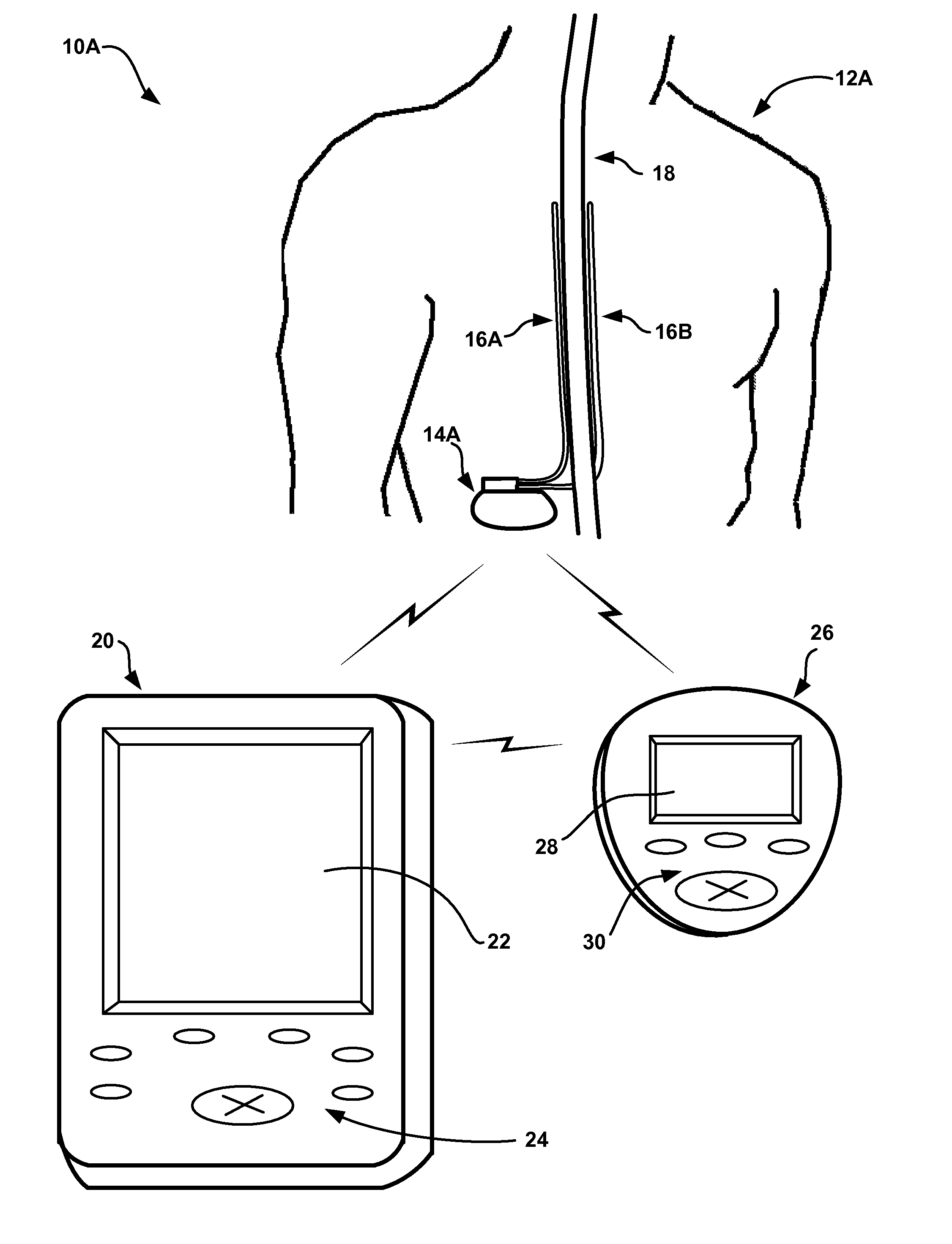 Controlling therapy based on sleep quality