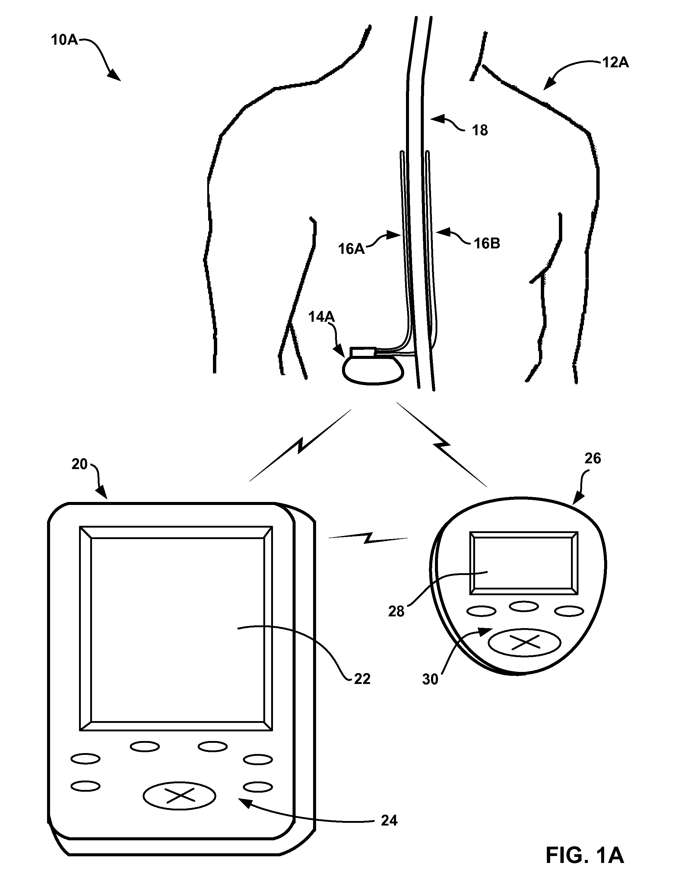 Controlling therapy based on sleep quality