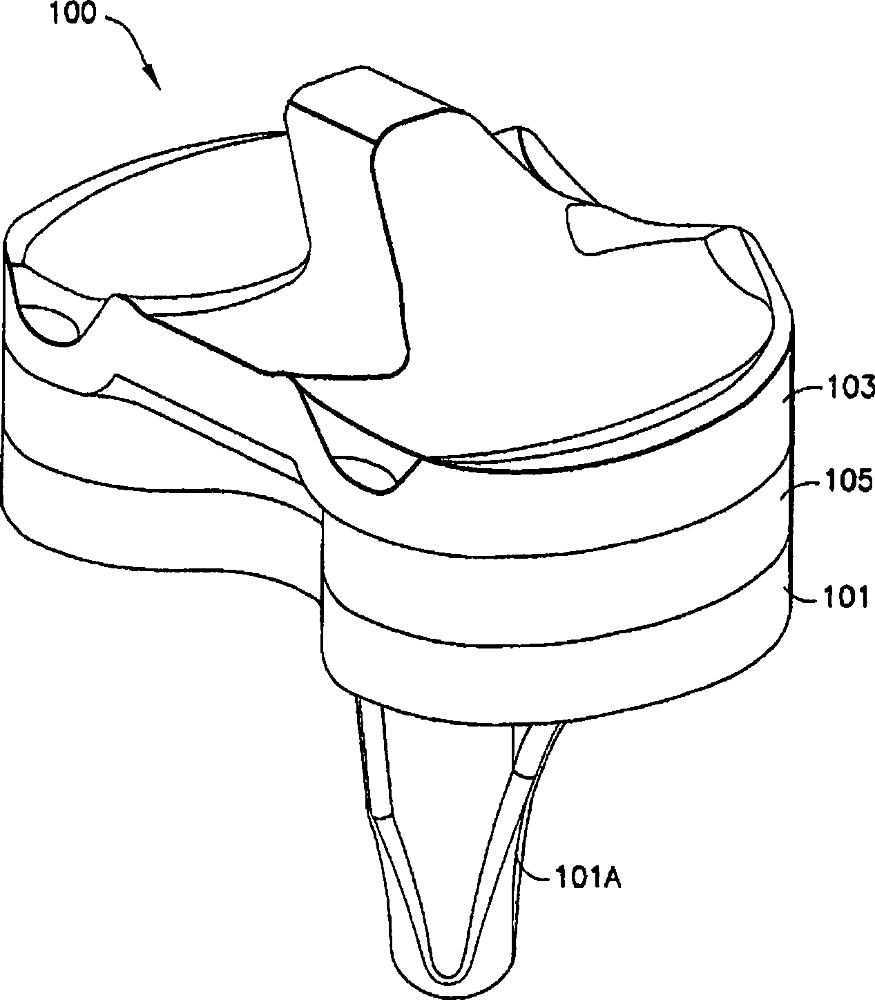 System and method for adjusting the thickness of a prosthesis