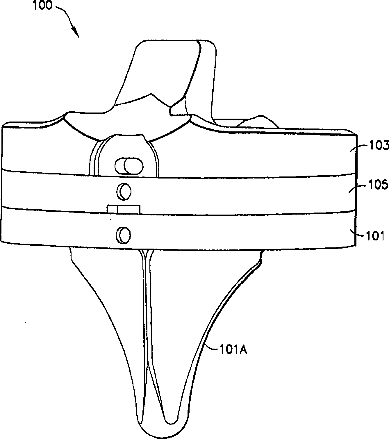 System and method for adjusting the thickness of a prosthesis