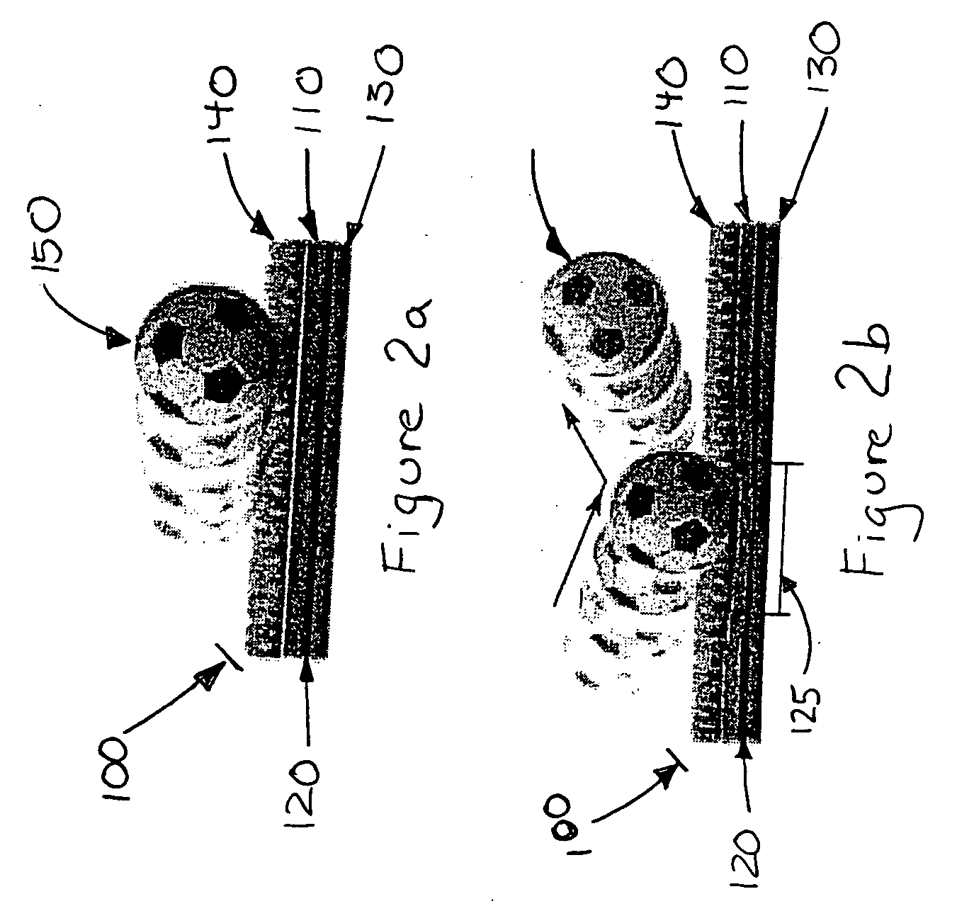 Underpad system