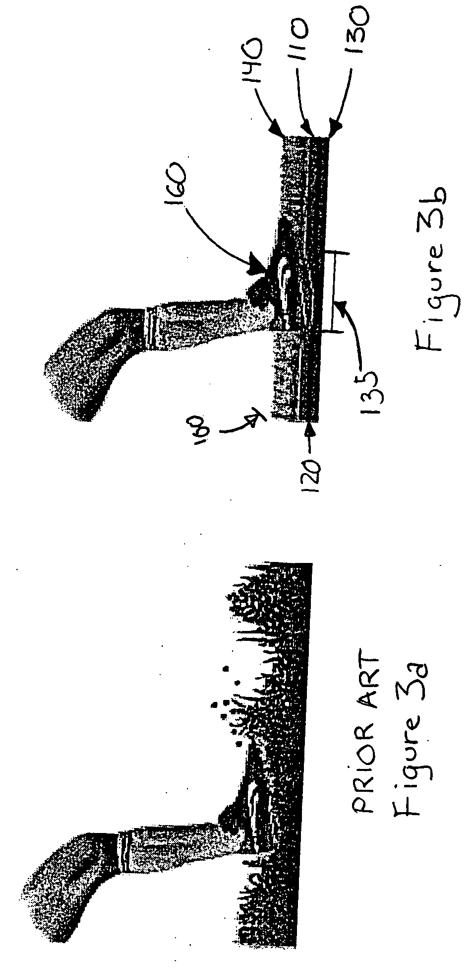 Underpad system