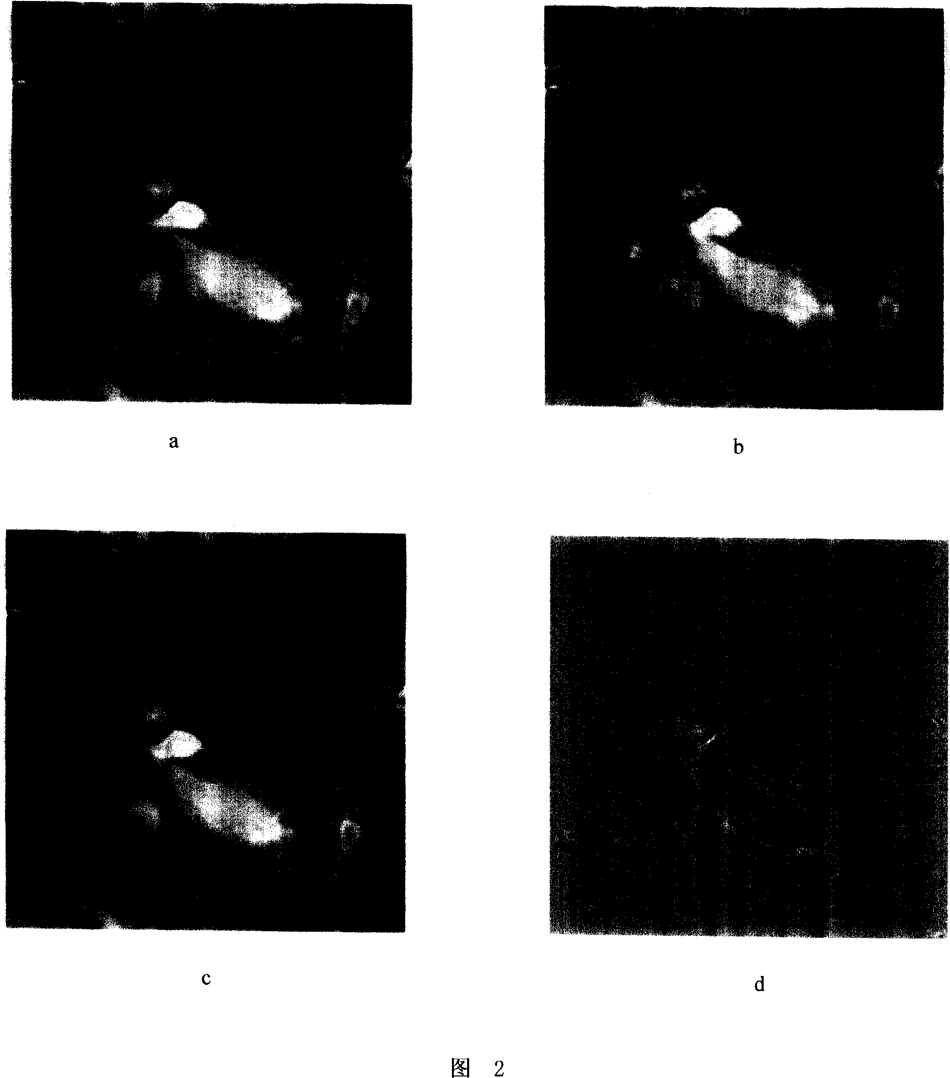 Image elastic registrating method based on limited sampling global optimisation