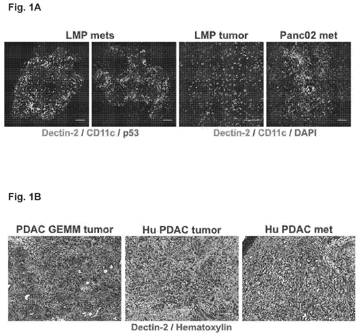 Methods and Compositions for Dectin-2 Stimulation and Cancer Immunotherapy