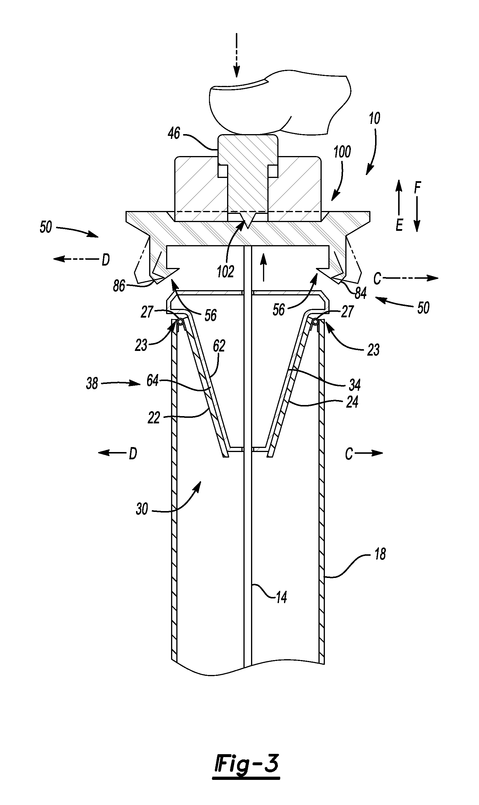 Fluid reservoir assembly