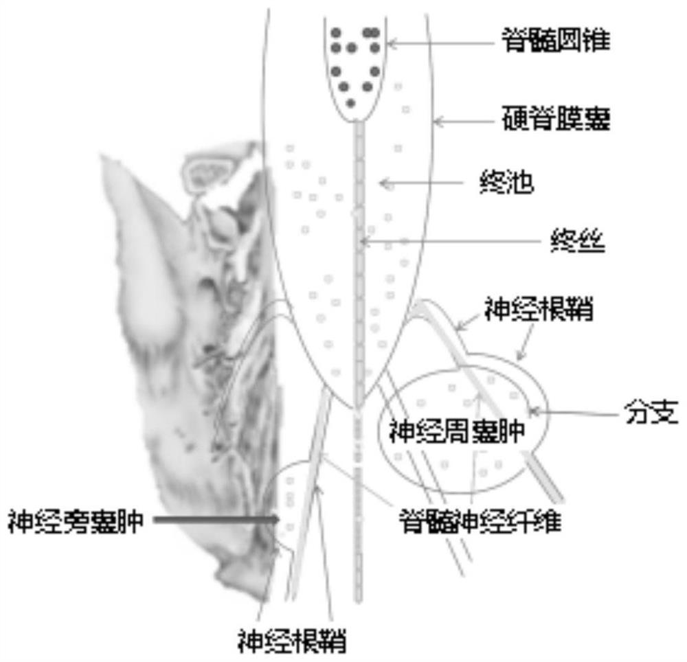 Method for establishing spinal dura mater semipermeable membrane type sacral canal cyst model