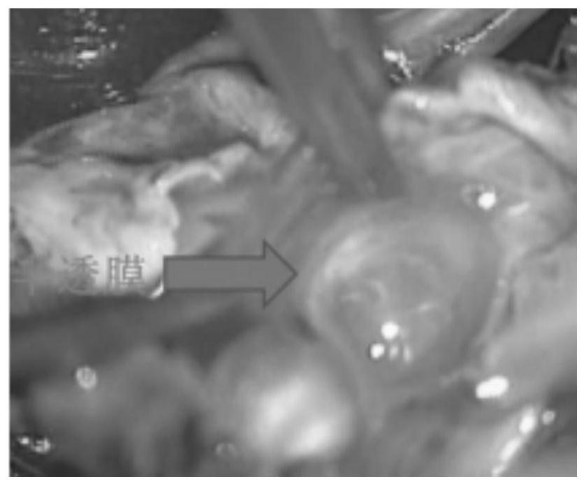 Method for establishing spinal dura mater semipermeable membrane type sacral canal cyst model