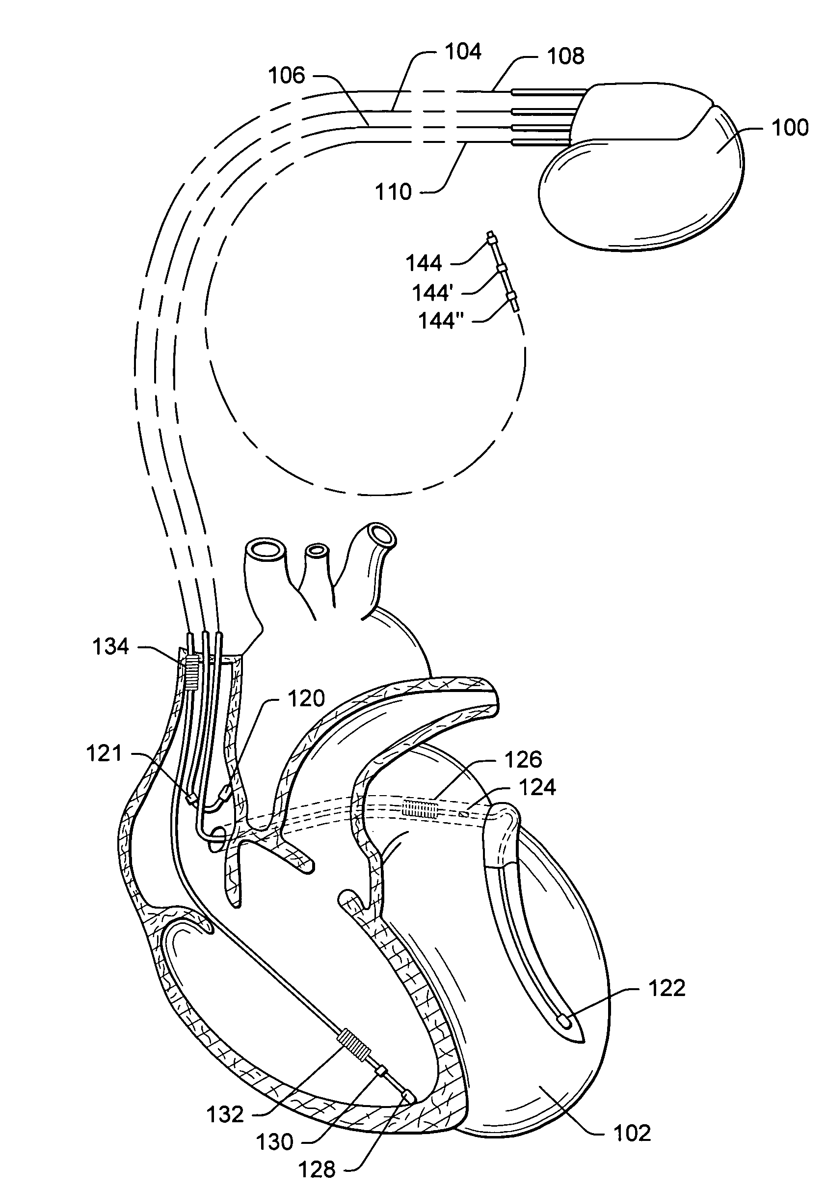 Techniques to maintain or alter upper airway patency