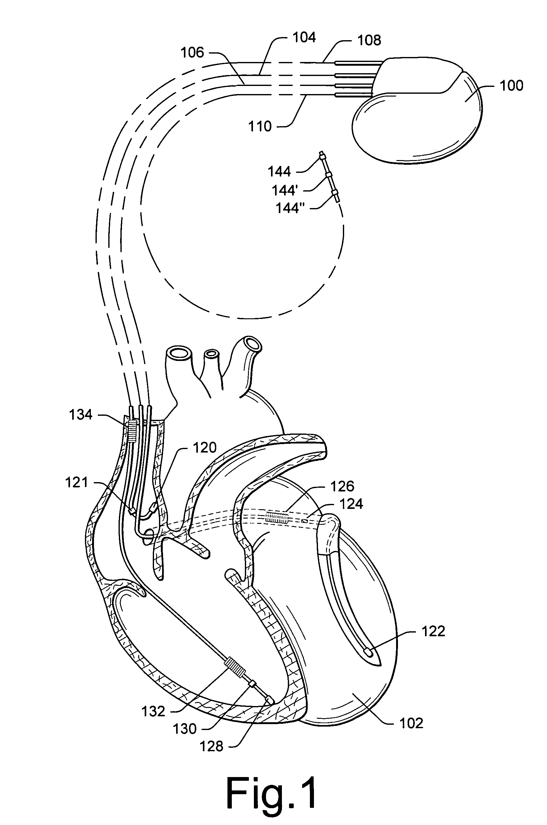 Techniques to maintain or alter upper airway patency