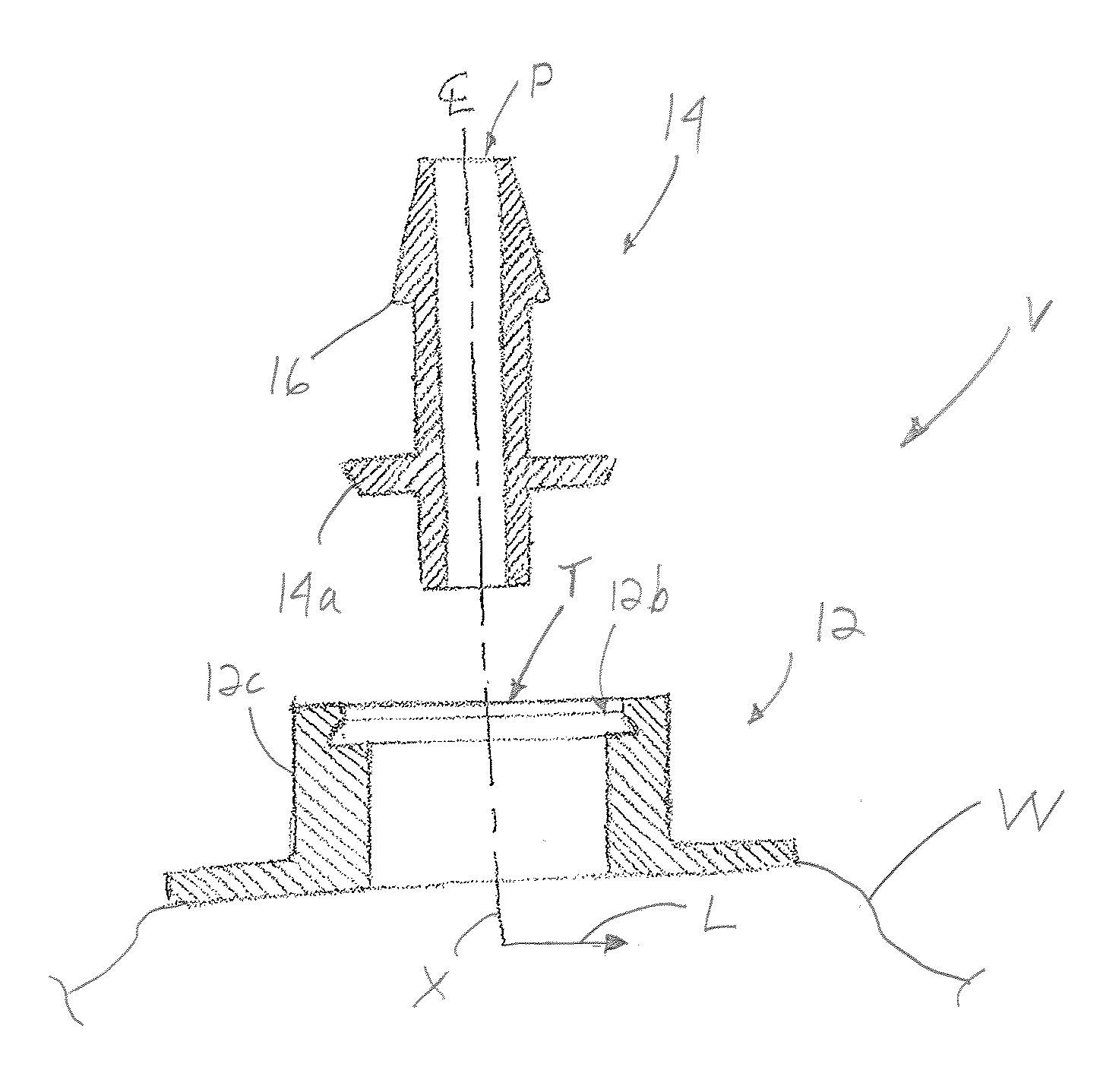 Configurable port fitment, kit, and related methods