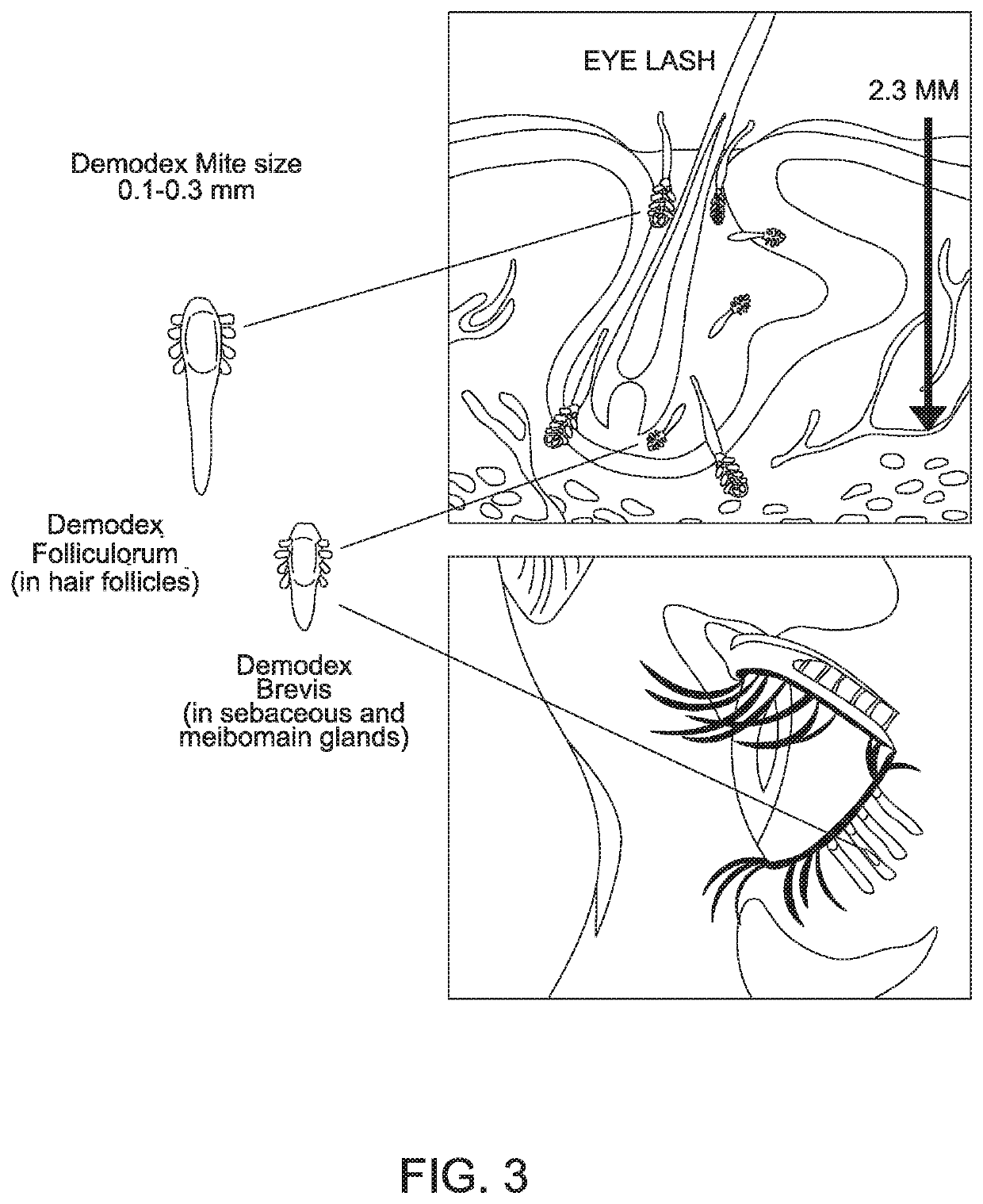 Treatment of Ophthalmological Conditions with Acetylcholinesterase Inhibitors