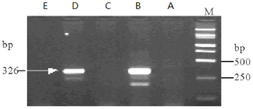 Lily virus gene chip and preparation method thereof as well as method for detecting lily viruses using lily virus gene chip