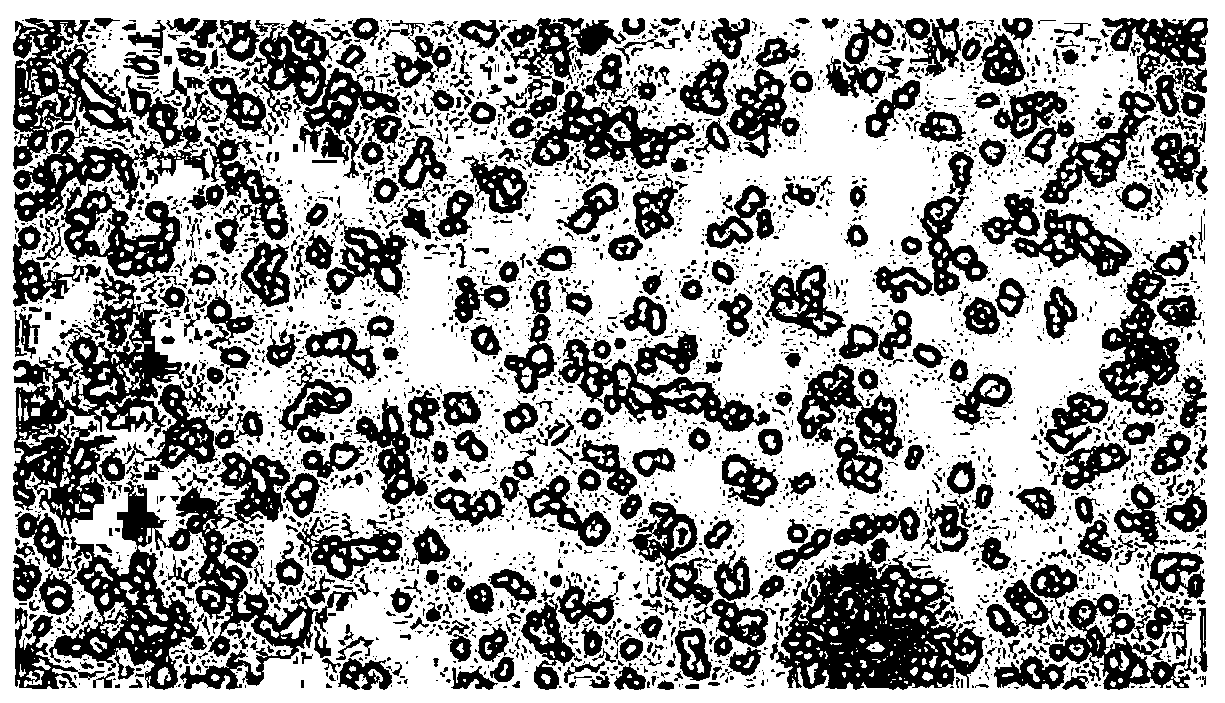 A highly metastatic human ovarian cancer cell line derived from lung metastases and its establishment and application