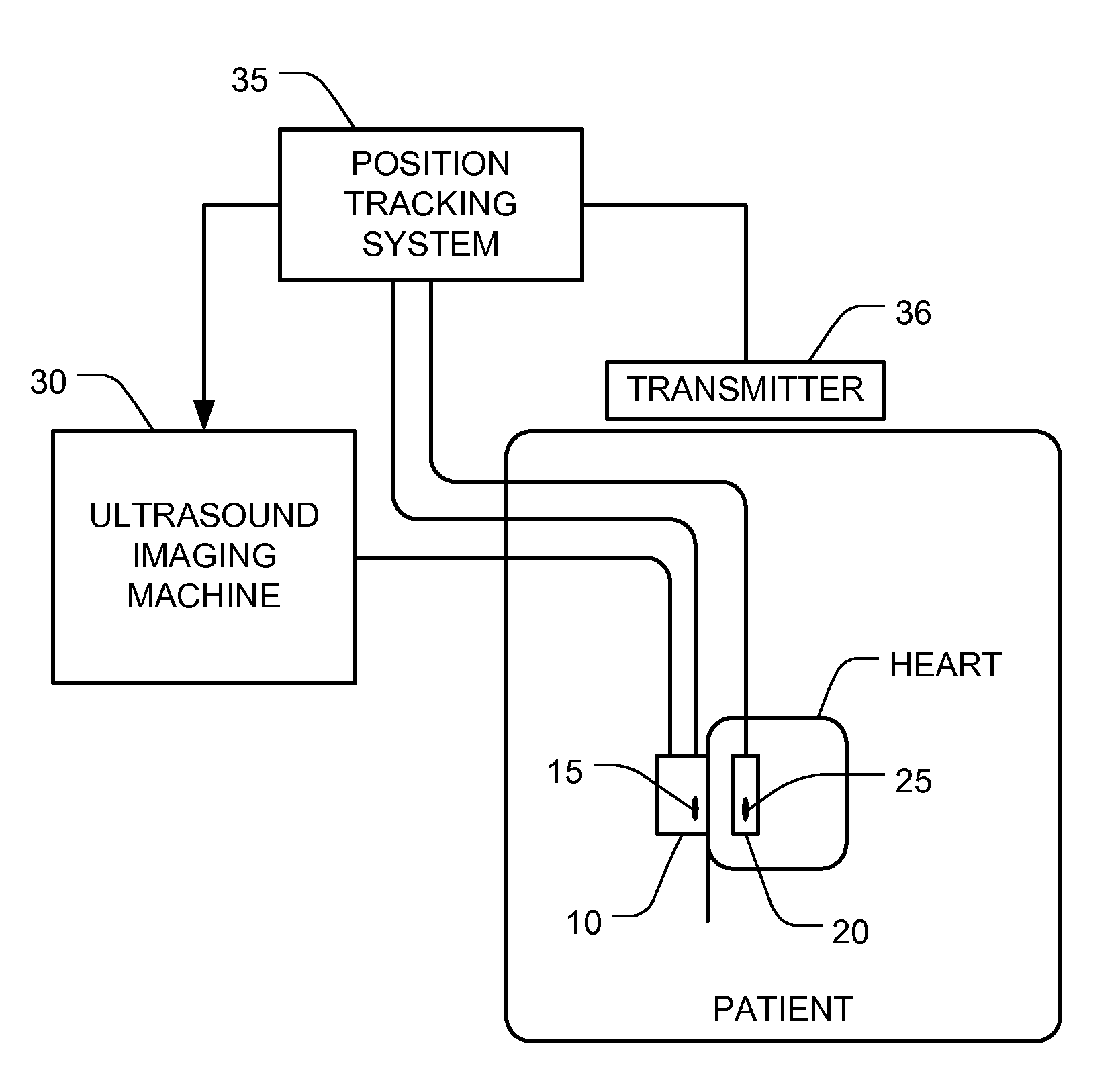 Ultrasound guided positioning of cardiac replacement valves with 3D visualization