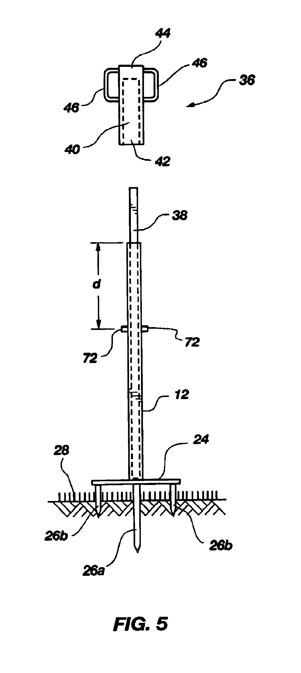 Removable sign support system