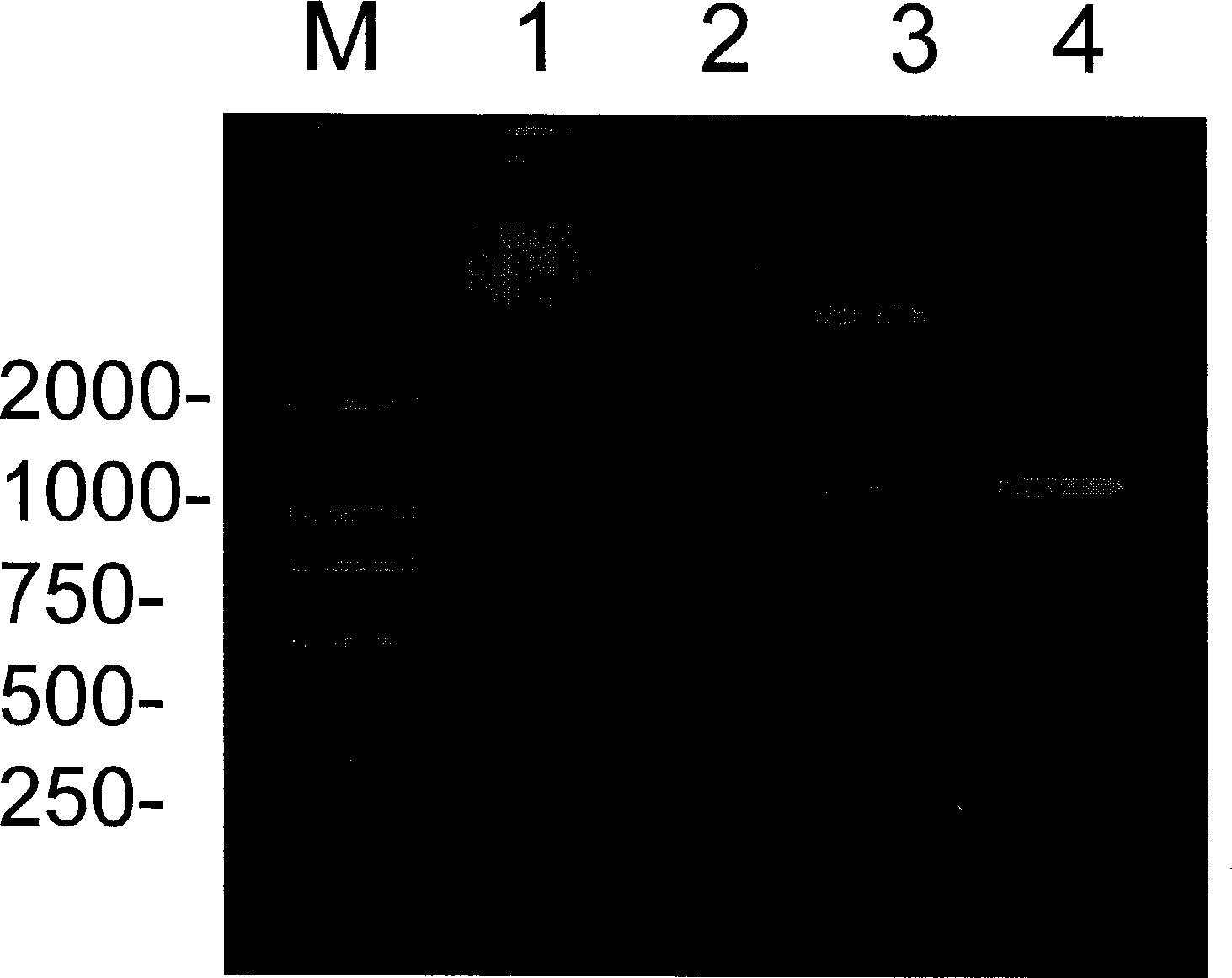 Conjugated protein Tau of microtubule of earthworm, its coding gene, and application