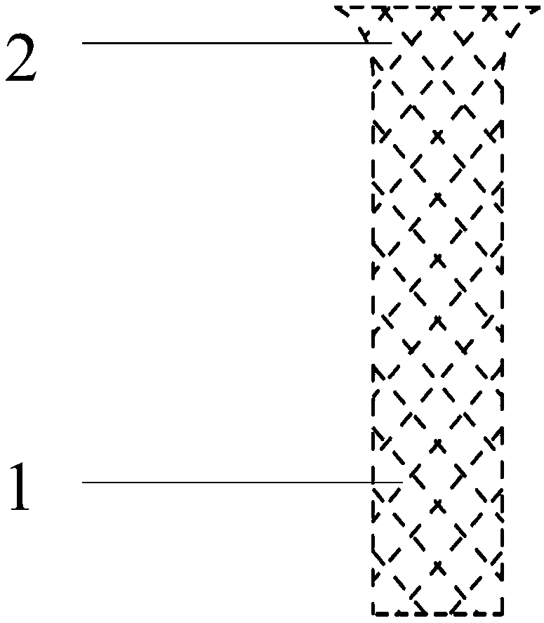 A special edge border double -ball pocket bracket system for split disease intervention treatment