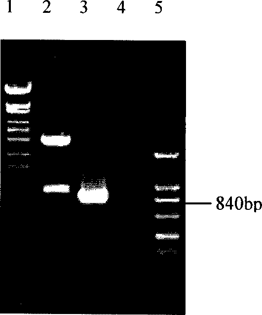 Recombinant akabane virus capsid protein, its preparation method and uses