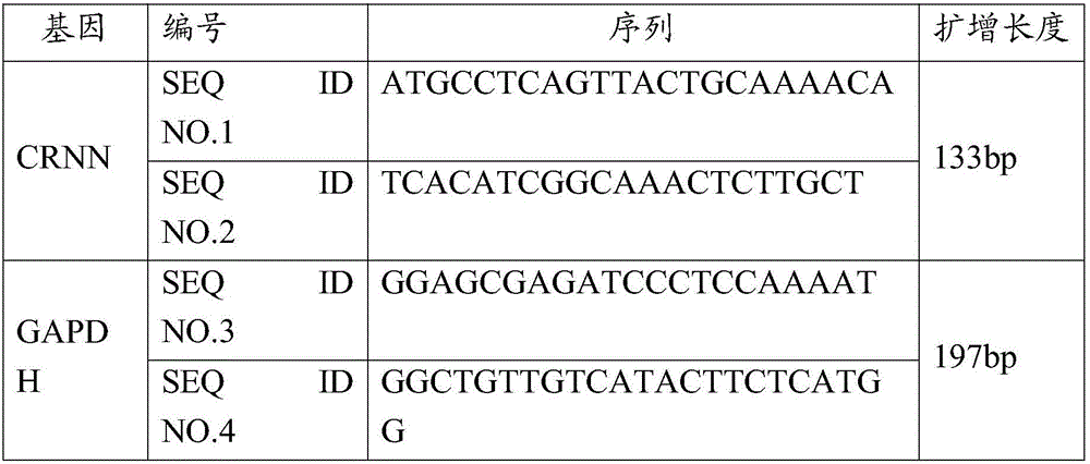 Osteoarthritis diagnosing product and application thereof