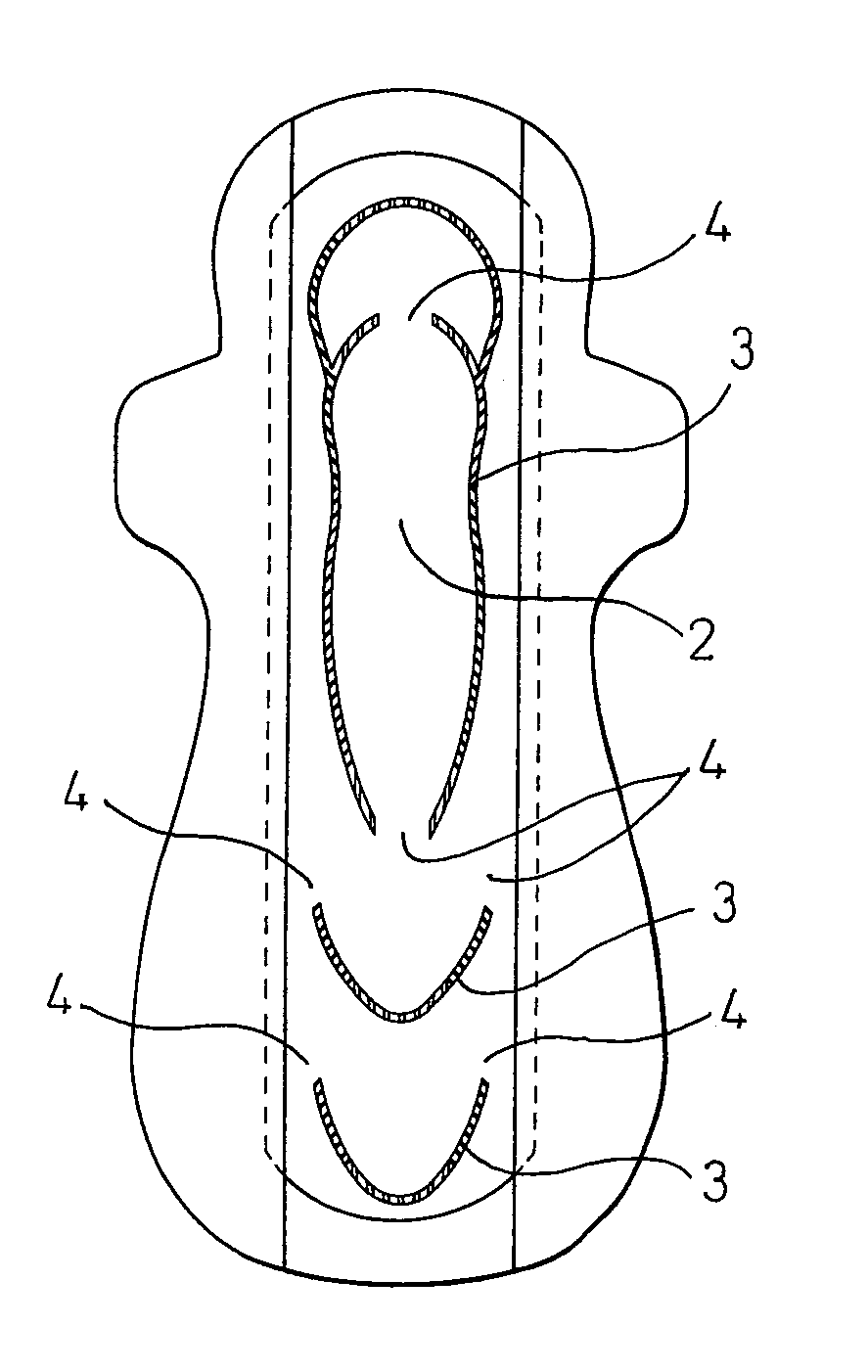 Absorbent article