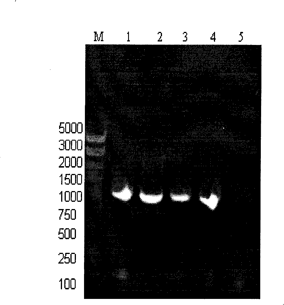 Inhibin DNA vaccine capable of improving animal fertility, and preparation and use thereof