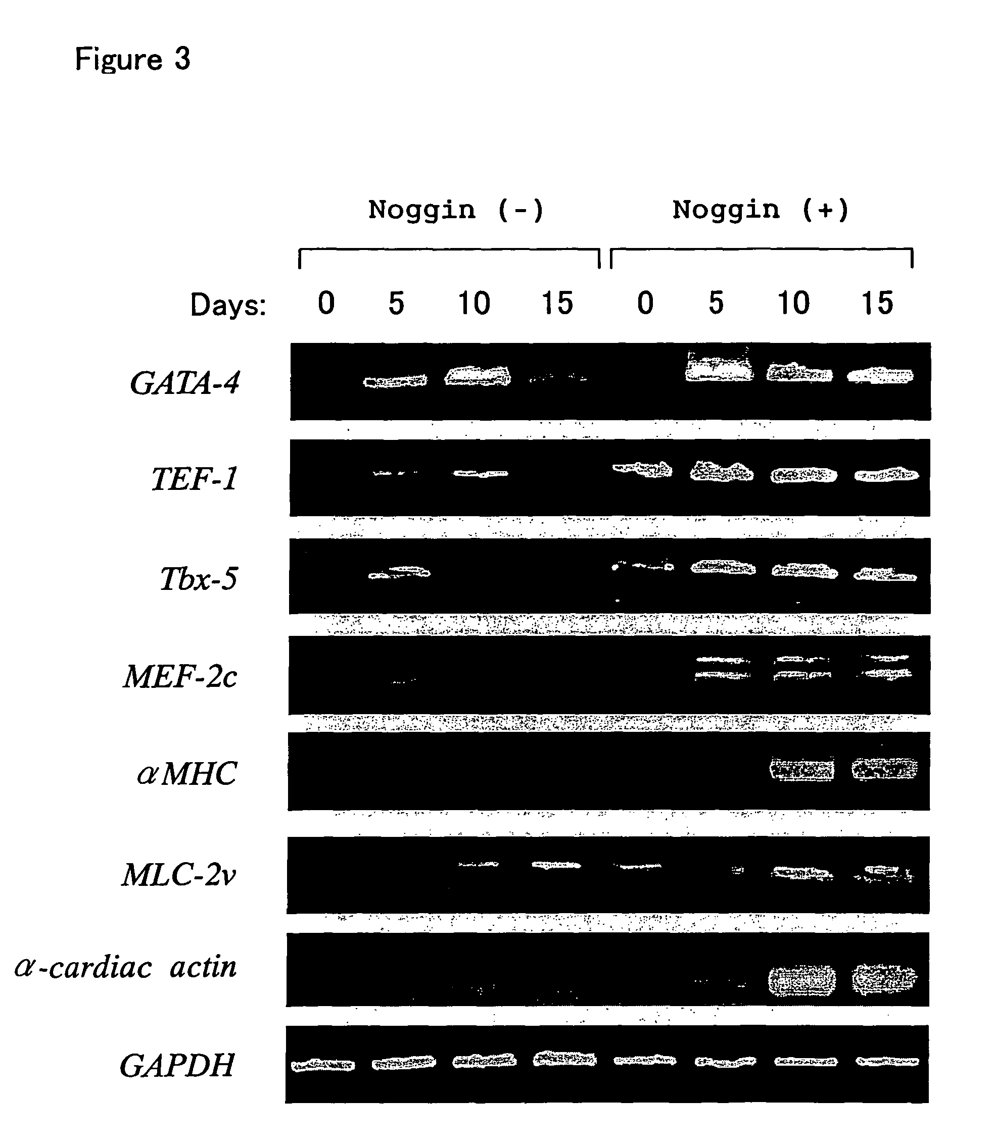 Method of inducing the differentiation of stem cells into myocardial cells