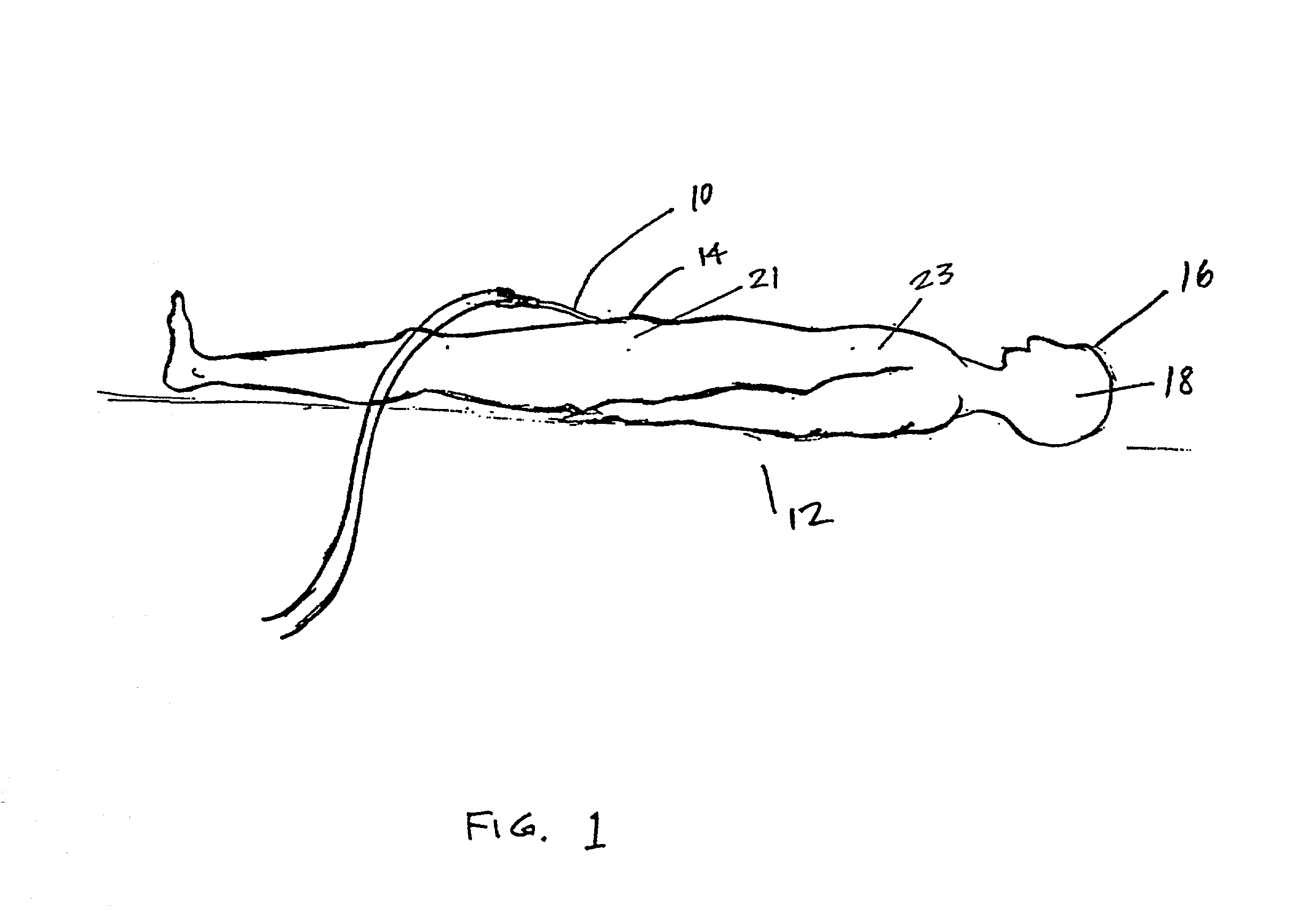 Indwelling heat exchange catheter and method of using same