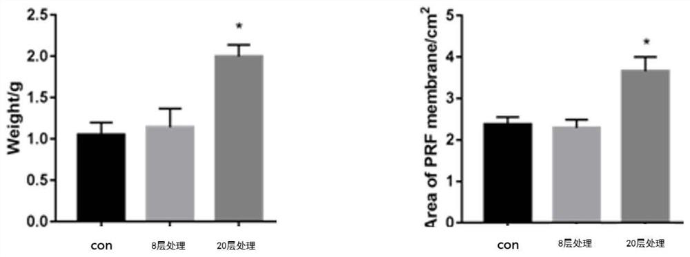 Optimized preparation method of solid platelet-rich fibrin film