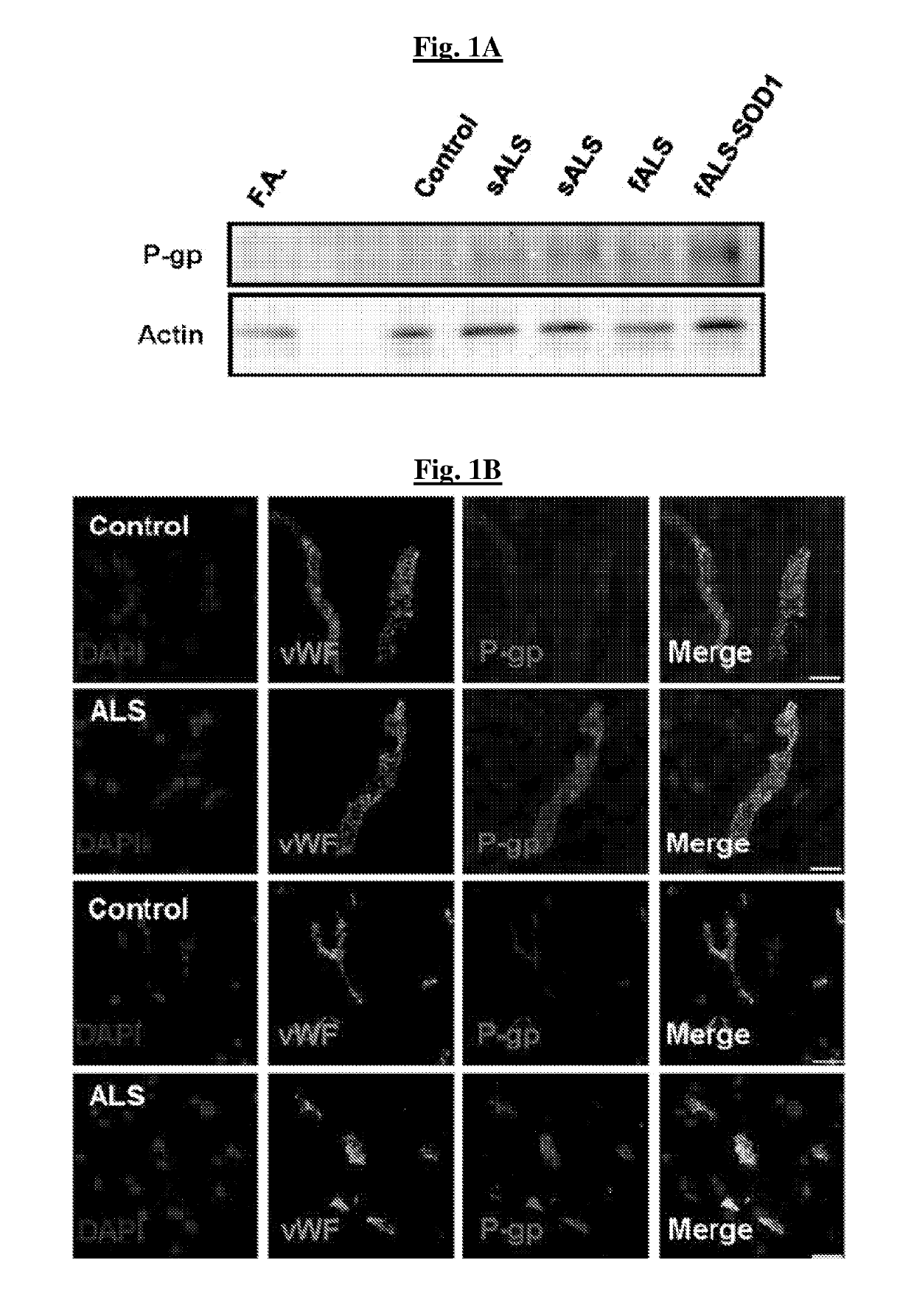 Methods of treating a neurodegenerative disease in a mammal in need thereof