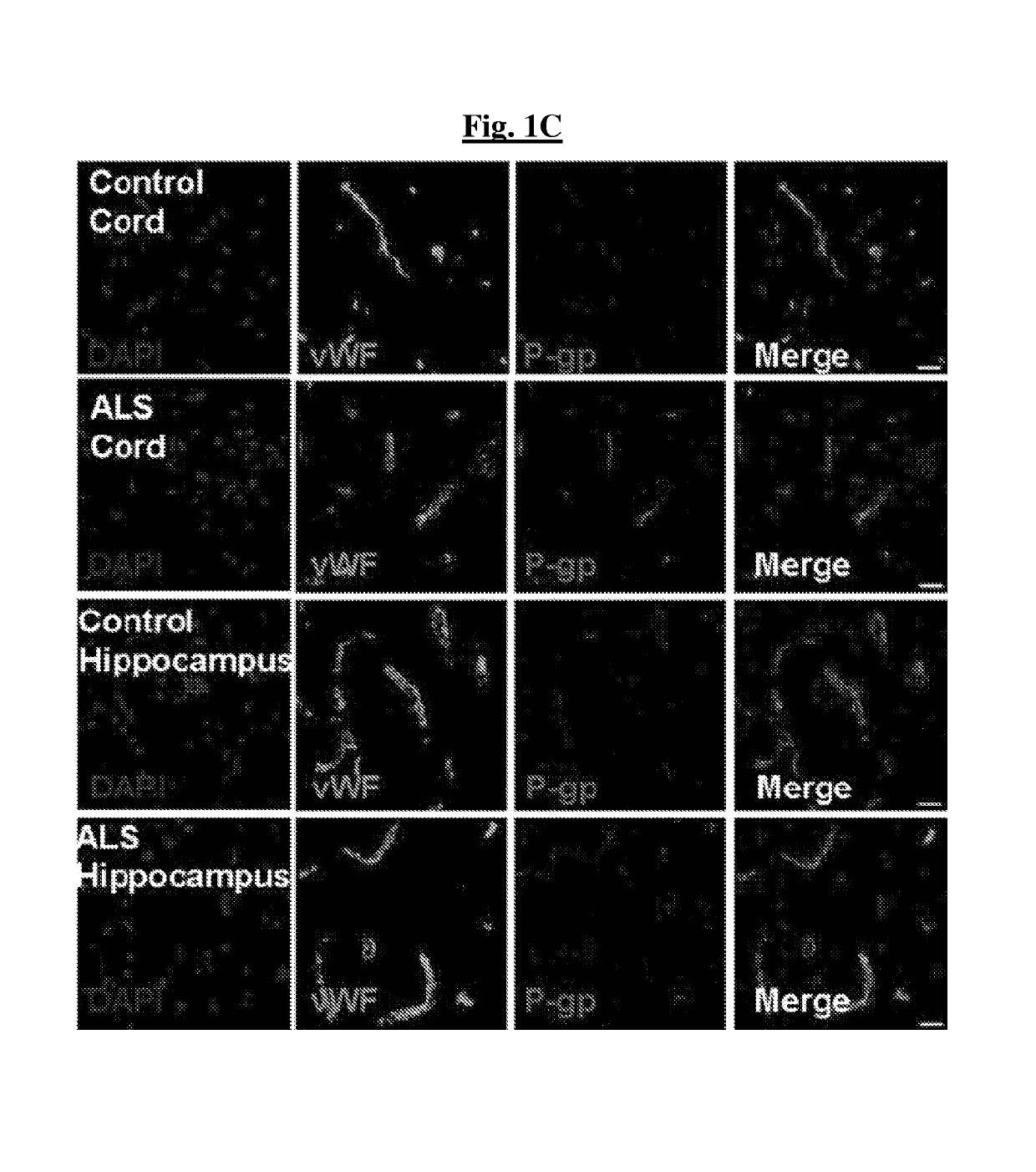 Methods of treating a neurodegenerative disease in a mammal in need thereof